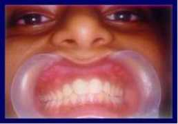 kkvakilorthodontics.com Nisarg