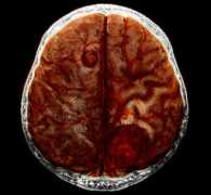 news.allcancercure.com Oncology