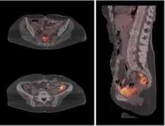 funscrape.com Ovarian