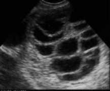 ivf.com Ovind