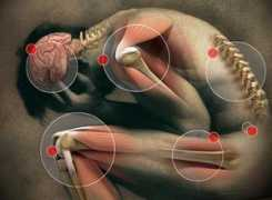 myfibro.com Pain