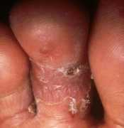 funscrape.com Pedis