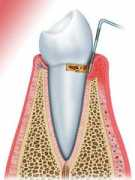 odontologia-infantil.com Periodoncia