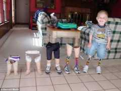 eupodiatamatando.com Pernas