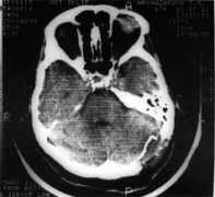 neuro-med.ru Petrosi