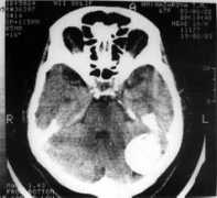 neuro-med.ru Petrosi