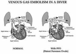 Pfo