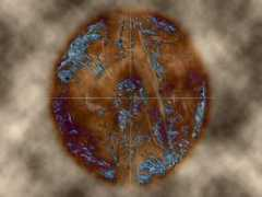 Phycho