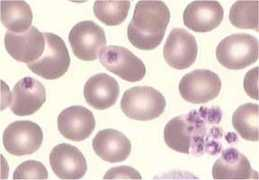 bioimage.free.fr Plamas