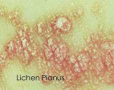 orlandoskindoc.com Planus