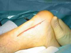 thefootandankleclinic.com Postero