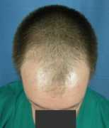 hairsite.com Poswal