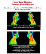 newdimensionthermography.com Preven