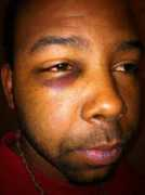 blog.chron.com Prevot