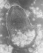 Protozoa