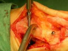 thefootandankleclinic.com Proximal