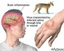 nursingcrib.com Rabies