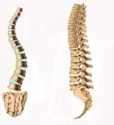scoliosipadova.net Rachide