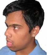 lebenshilfeindia.org Ravikumar