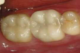 jeffklinedds.com Restorative