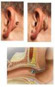 Retrox