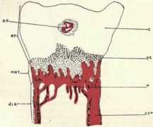 chestofbooks.com Rickets