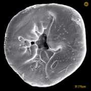 foraminifera.eu Rosalina