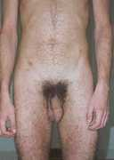 Rubbal
