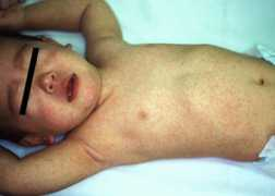 nsknet.or.jp Rubella