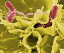 biologyguide.net Sepsis