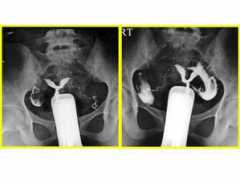 Septus