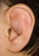 pinna.hawkelibrary.com Seroma
