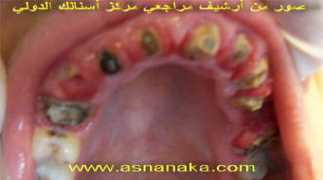 asnanaka.com Shanaf