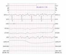 physionet.mit.edu Shhs