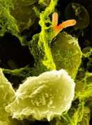 foodpoisonjournal.com Shigella