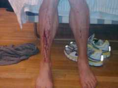 runblogrun.com Solinsky