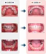 anton-ortho.com Sousei