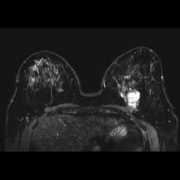 clinical.netforum.healthcare.philips.com Spair