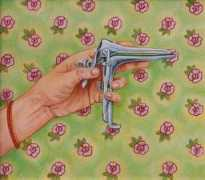 Speculum