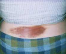 coccyx.org Stacie