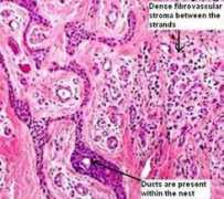 histopathology-india.net Syfi