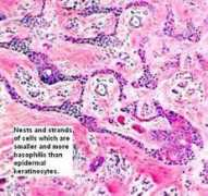 histopathology-india.net Syfi
