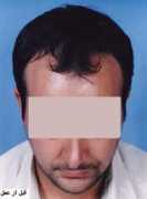 tehranhair.com Tayebi