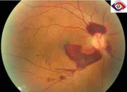 sarawakeyecare.com Terson