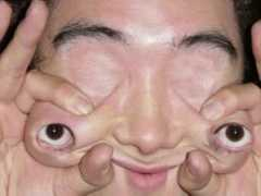 Theeyes