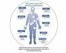 bme240.eng.uci.edu Therapies