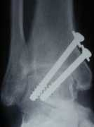 thefootandankleclinic.com Tibio