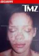 Tmz