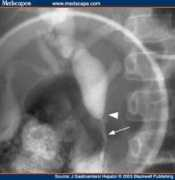 medscape.com Todani