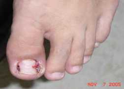 Toebe